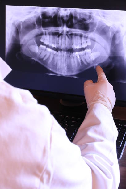 Best Emergency Treatment for Dental Infections or Abscesses in Clay Center, KS