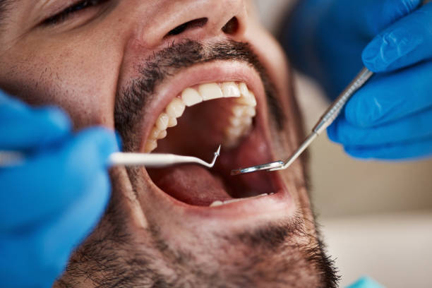 Best Emergency Dental Care for Broken or Chipped Teeth in Clay Center, KS
